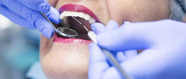 Best Emergency Gum Treatment in Eldersburg, MD